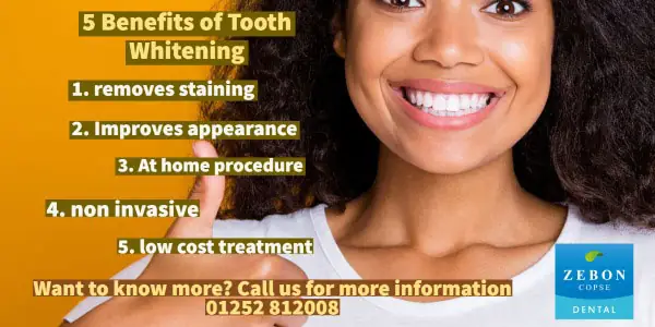 5 Benefits of Tooth Whitening